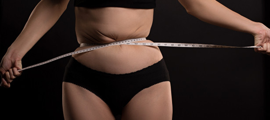 Things You Should Do Before Obesity Surgery