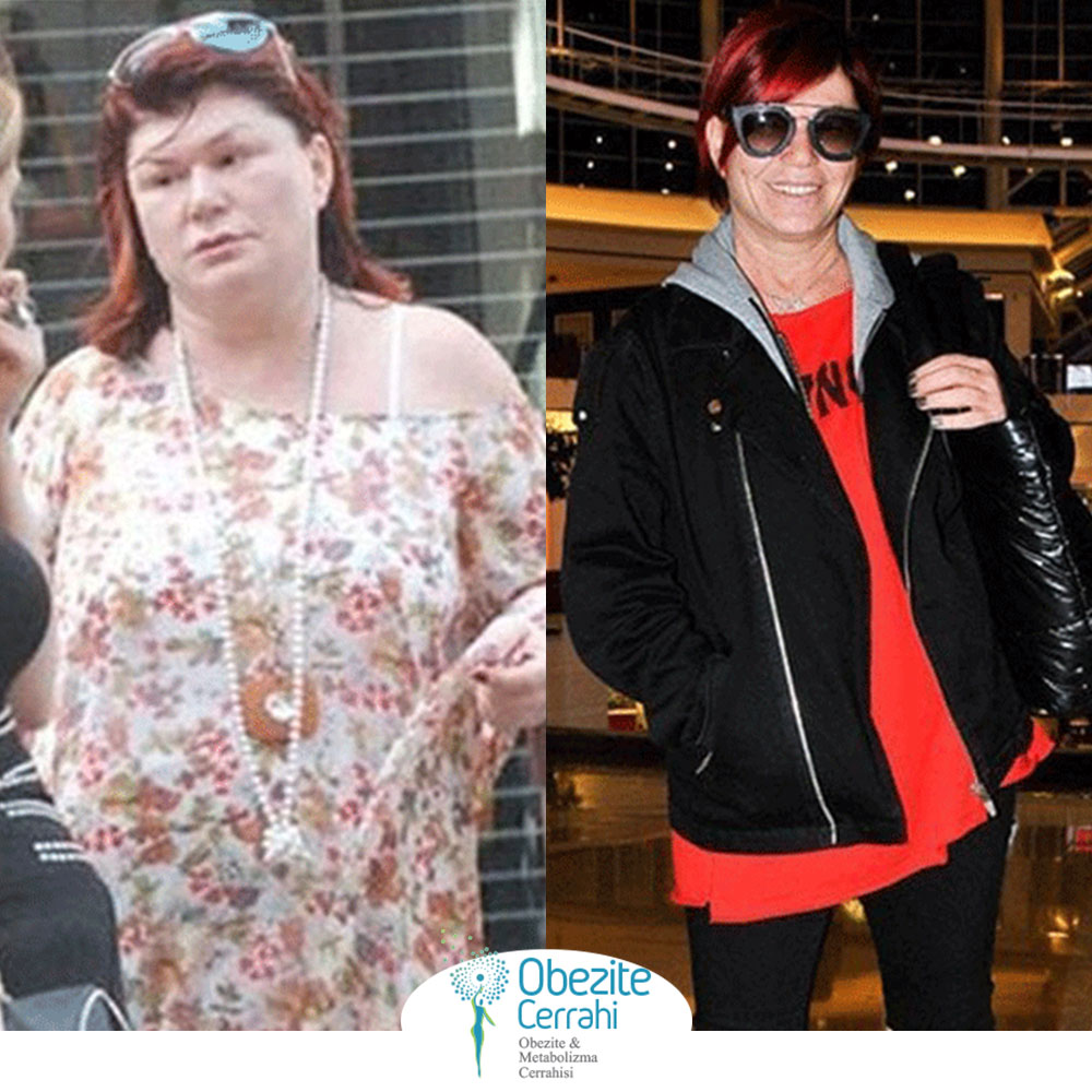 before-after