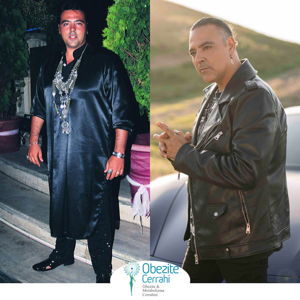 before-after