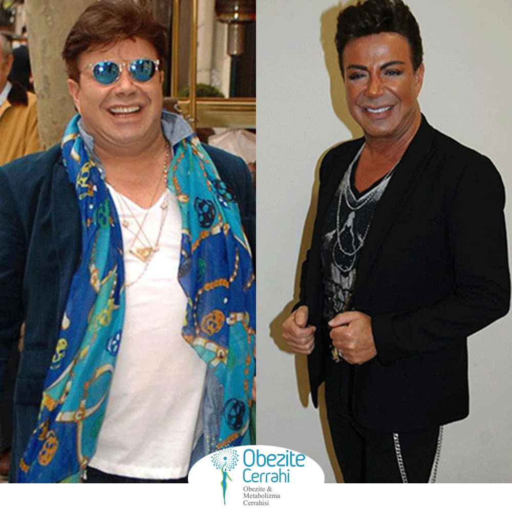 before-after