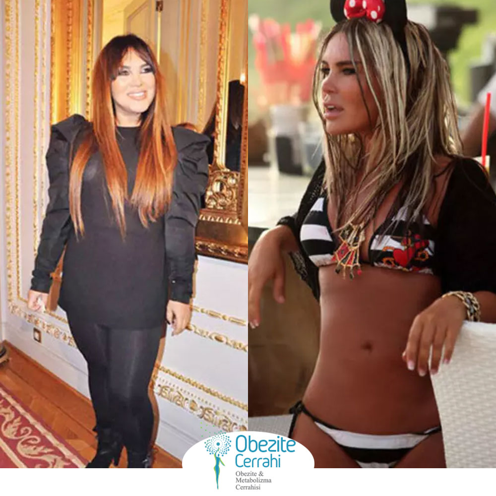 before-after
